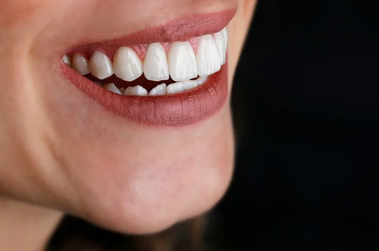 Smile design-9 (1)